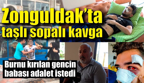Zonguldak'ta taşlı sopalı kavga!